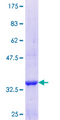 CNOT6 Protein - 12.5% SDS-PAGE Stained with Coomassie Blue.