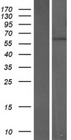 CNOT6L Protein - Western validation with an anti-DDK antibody * L: Control HEK293 lysate R: Over-expression lysate