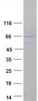 CNOT6L Protein - Purified recombinant protein CNOT6L was analyzed by SDS-PAGE gel and Coomassie Blue Staining