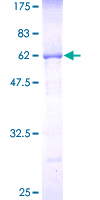 CNOT7 Protein - 12.5% SDS-PAGE of human CNOT7 stained with Coomassie Blue