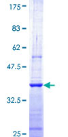 CNOT7 Protein - 12.5% SDS-PAGE Stained with Coomassie Blue.