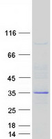 CNOT7 Protein - Purified recombinant protein CNOT7 was analyzed by SDS-PAGE gel and Coomassie Blue Staining