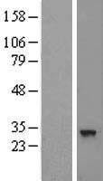 CNOT8 Protein - Western validation with an anti-DDK antibody * L: Control HEK293 lysate R: Over-expression lysate