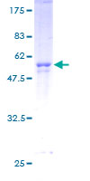 CNOT8 Protein - 12.5% SDS-PAGE of human CNOT8 stained with Coomassie Blue