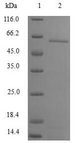 CNOT8 Protein - (Tris-Glycine gel) Discontinuous SDS-PAGE (reduced) with 5% enrichment gel and 15% separation gel.