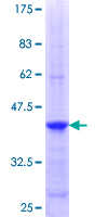 CNOT8 Protein - 12.5% SDS-PAGE Stained with Coomassie Blue.