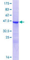 Cnpy2 / TMEM4 Protein - 12.5% SDS-PAGE of human CNPY2 stained with Coomassie Blue