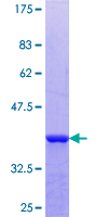 Cnpy2 / TMEM4 Protein - 12.5% SDS-PAGE Stained with Coomassie Blue.