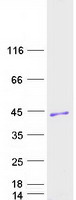 CNPY4 Protein - Purified recombinant protein CNPY4 was analyzed by SDS-PAGE gel and Coomassie Blue Staining