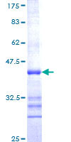 CNR1 / CB1 Protein - 12.5% SDS-PAGE Stained with Coomassie Blue.