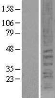 CNR2 / CB2 Protein - Western validation with an anti-DDK antibody * L: Control HEK293 lysate R: Over-expression lysate