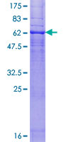 CNR2 / CB2 Protein - 12.5% SDS-PAGE of human CNR2 stained with Coomassie Blue