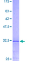 CNR2 / CB2 Protein - 12.5% SDS-PAGE Stained with Coomassie Blue.