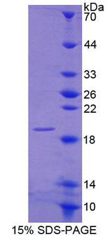 CNRIP1 Protein - Recombinant Cannabinoid Receptor Interacting Protein 1 (CNRIP1) by SDS-PAGE