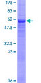CNTD1 Protein - 12.5% SDS-PAGE of human CNTD stained with Coomassie Blue