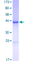 CNTF Protein - 12.5% SDS-PAGE of human CNTF stained with Coomassie Blue