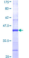 CNTFR Protein - 12.5% SDS-PAGE Stained with Coomassie Blue.