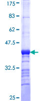 CNTLN Protein - 12.5% SDS-PAGE Stained with Coomassie Blue.