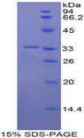 CNTN1 / gp135 / Contactin 1 Protein - Recombinant Contactin 1 By SDS-PAGE
