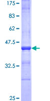 CNTN2 / TAX Protein - 12.5% SDS-PAGE Stained with Coomassie Blue.