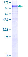 CNTN4 Protein - 12.5% SDS-PAGE of human CNTN4 stained with Coomassie Blue