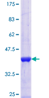 CNTN4 Protein - 12.5% SDS-PAGE Stained with Coomassie Blue.