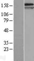 CNTNAP1 / CASPR / p190 Protein - Western validation with an anti-DDK antibody * L: Control HEK293 lysate R: Over-expression lysate