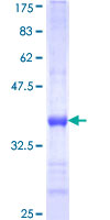 CNTNAP5 Protein - 12.5% SDS-PAGE Stained with Coomassie Blue.