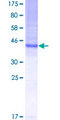 CO-029 / TSPAN8 Protein - 12.5% SDS-PAGE of human TSPAN8 stained with Coomassie Blue
