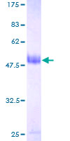 COA7 / SELRC1 Protein - 12.5% SDS-PAGE of human C1orf163 stained with Coomassie Blue