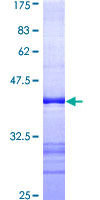 COAA / RBM14 Protein - 12.5% SDS-PAGE Stained with Coomassie Blue.
