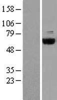 COASY Protein - Western validation with an anti-DDK antibody * L: Control HEK293 lysate R: Over-expression lysate