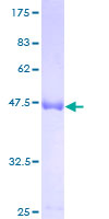 COASY Protein - 12.5% SDS-PAGE of human COASY stained with Coomassie Blue