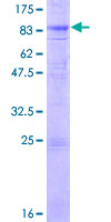 Cochlin / COCH Protein - 12.5% SDS-PAGE of human COCH stained with Coomassie Blue