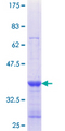COG1 Protein - 12.5% SDS-PAGE Stained with Coomassie Blue.