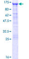 COG3 Protein - 12.5% SDS-PAGE of human COG3 stained with Coomassie Blue