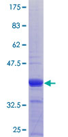 COG3 Protein - 12.5% SDS-PAGE Stained with Coomassie Blue.