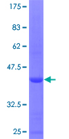 COG4 Protein - 12.5% SDS-PAGE Stained with Coomassie Blue.