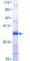 COG6 Protein - 12.5% SDS-PAGE Stained with Coomassie Blue.