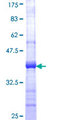 COG6 Protein - 12.5% SDS-PAGE Stained with Coomassie Blue.