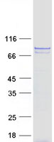COG7 Protein - Purified recombinant protein COG7 was analyzed by SDS-PAGE gel and Coomassie Blue Staining