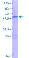 COG8 Protein - 12.5% SDS-PAGE of human COG8 stained with Coomassie Blue