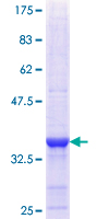 COG8 Protein - 12.5% SDS-PAGE Stained with Coomassie Blue.