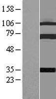 COIL / Coilin Protein - Western validation with an anti-DDK antibody * L: Control HEK293 lysate R: Over-expression lysate