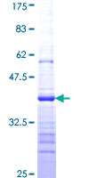 COIL / Coilin Protein - 12.5% SDS-PAGE Stained with Coomassie Blue.