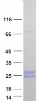 COL10A1 / Collagen X Protein - Purified recombinant protein COL10A1 was analyzed by SDS-PAGE gel and Coomassie Blue Staining