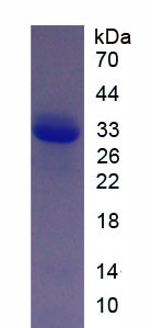 COL11A1 / Collagen XI Alpha 1 Protein - Recombinant Collagen Type XI Alpha 1 (COL11a1) by SDS-PAGE