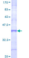 COL11A2 / Collagen XI Protein - 12.5% SDS-PAGE Stained with Coomassie Blue.