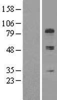 COL13A1 / Collagen XIII Protein - Western validation with an anti-DDK antibody * L: Control HEK293 lysate R: Over-expression lysate