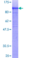 COL14A1 / Collagen XIV Protein - 12.5% SDS-PAGE of human COL14A1 stained with Coomassie Blue